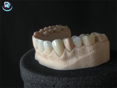 Zircon or ceramic? How to choose an orthopedic crown?
