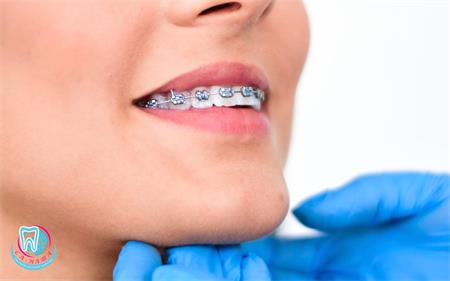 Детская стоматологическая ортодонтия — как правильный прикус влияет на здоровье ребенка?