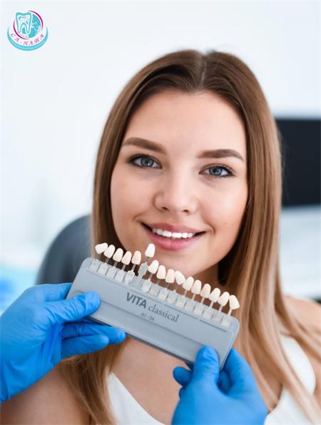 How does laser whitening work in the network of clinics 