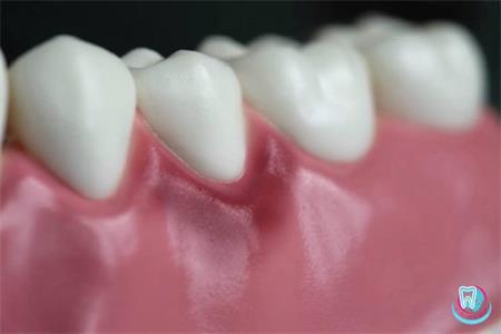 Найпоширеніші причини втрати зубів:
