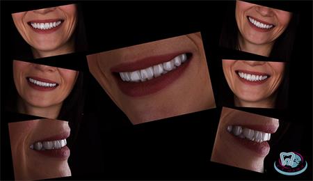 All about aesthetic dentistry