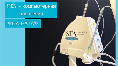 Комп'ютерна анестезія STA