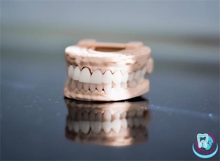 Технологія CAD-CAM у стоматології дозволяє створювати різні типи коронок, включаючи: