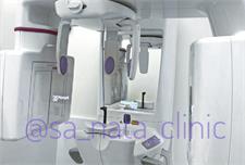 Рентгенография. Рентген-диагностика зубов в клинике СА-НАТА