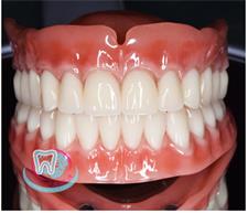 знімне протезування зубів