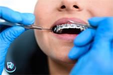 Orthodontics (bite correction)