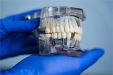 Чем занимается гнатология в стоматологии?