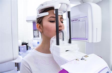Компьютерная томография зуба  — оборудование для проведения обследования