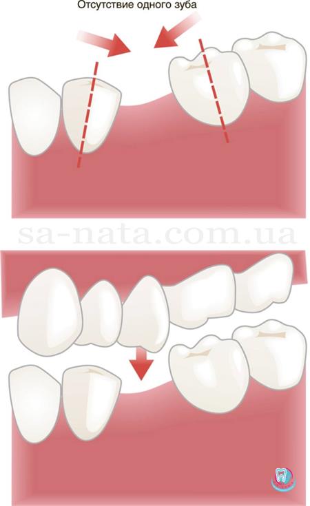 Насколько опасны болезни стоматологии и как избежать потери зубов