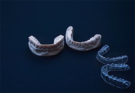 Advantages of using aligners: