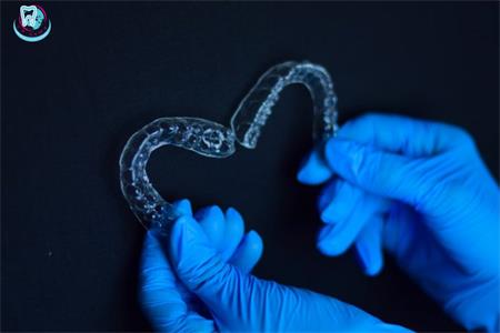 What do you need to know about aligners?