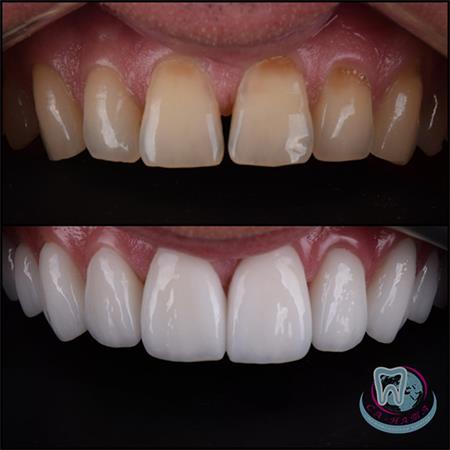 Ортопедична стоматологія