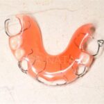 детское протезирование