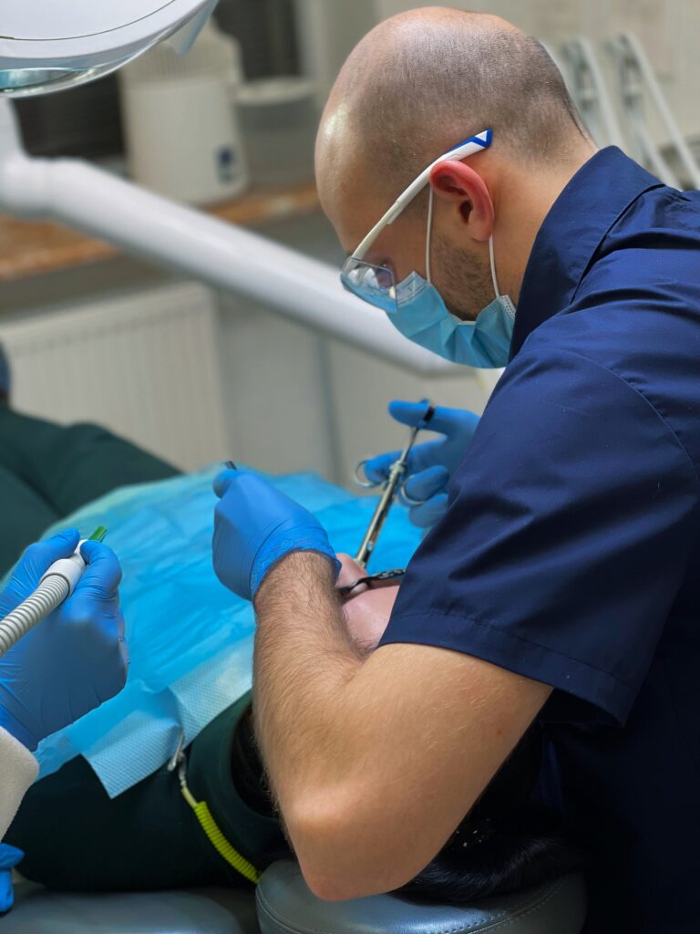 Ультразвукова чистка