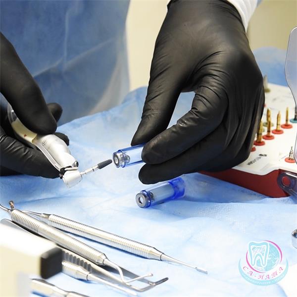 Имплантация зубов Киев — хирургическая подготовка к установке зубного импланта