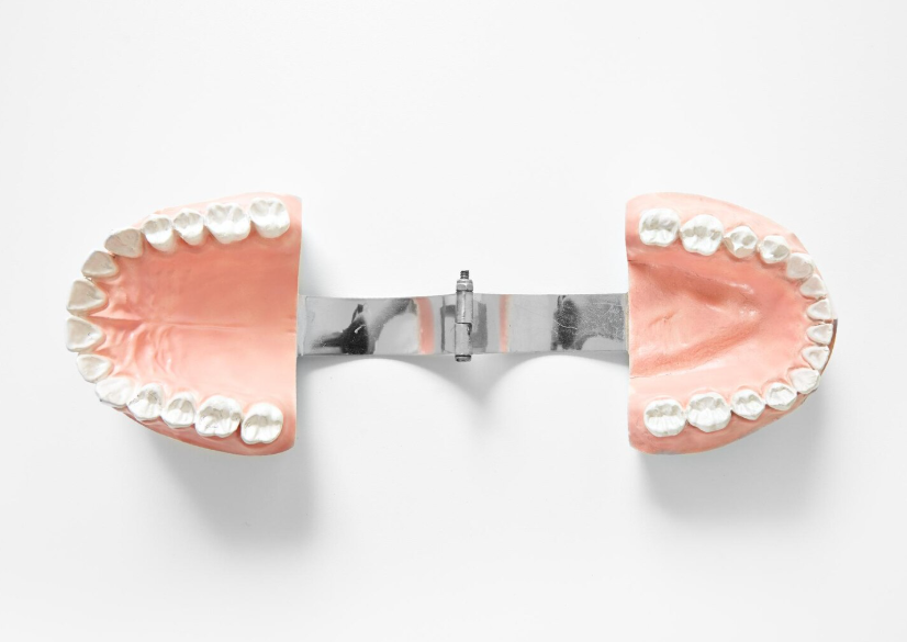 All-on-4 имплантация зубов — стоматологическая модель для планирования установки имплантов