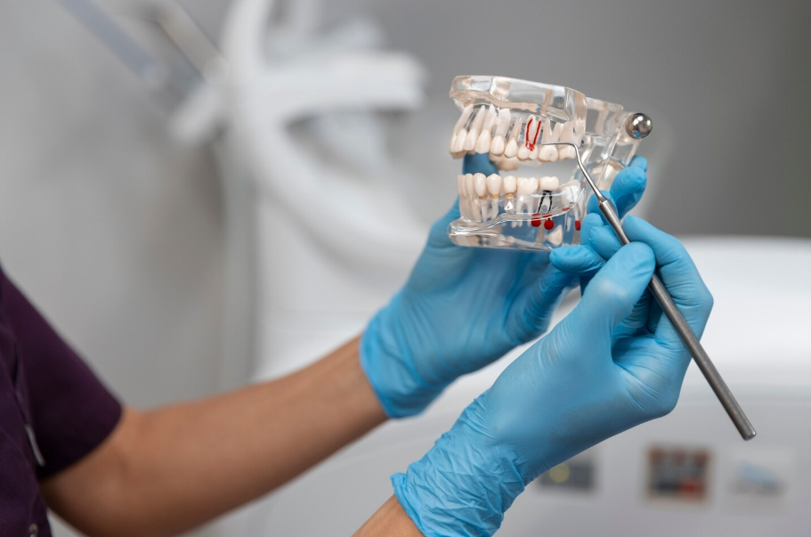 Лазерная имплантация зубов — стоматолог показывает на модели челюсти установку дентальных имплантов без скальпеля