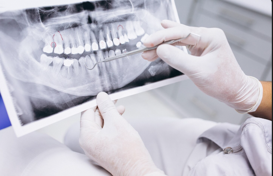 Почему темнеют зубы