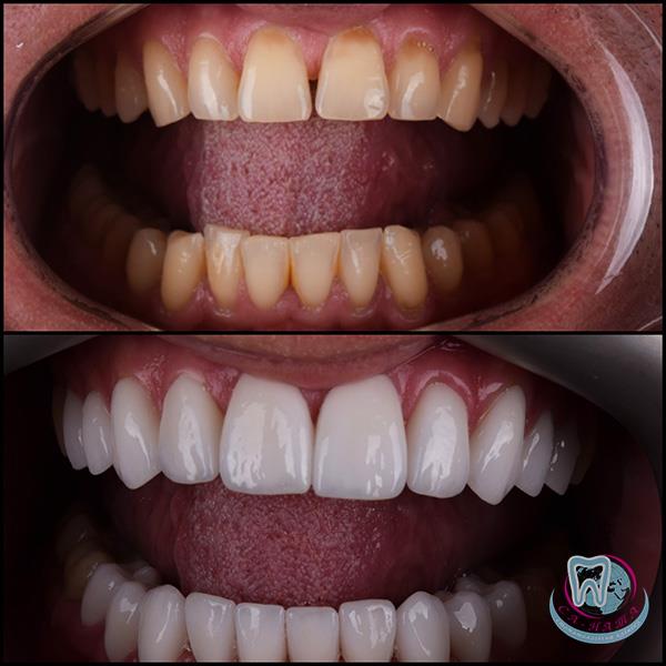 Методы лечения которые чаще всего используют