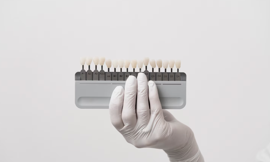 Керамические виниры — все, что нужно знать