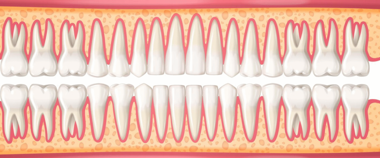 Мягкие ткани полости рта