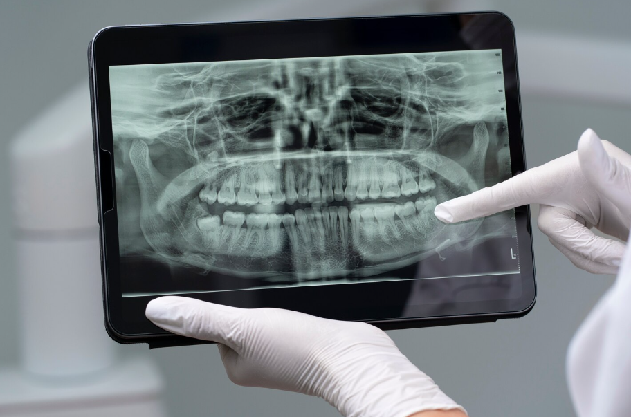 3D рентген зубов
