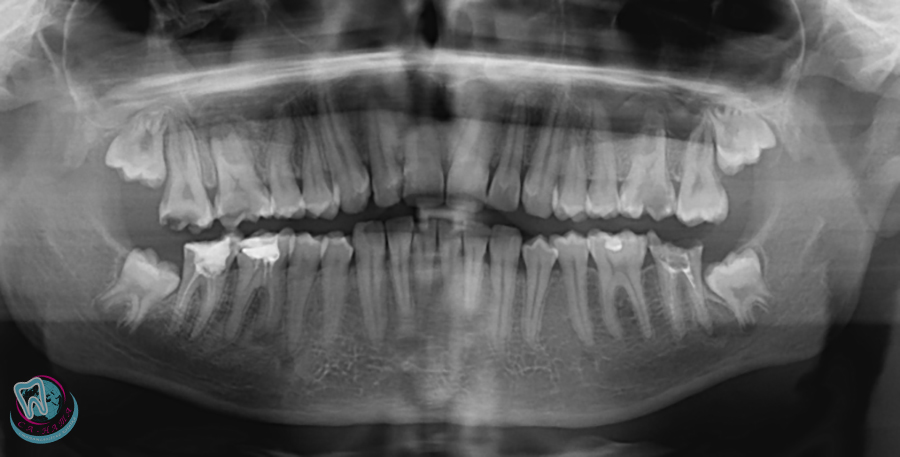 Панорамный снимок
