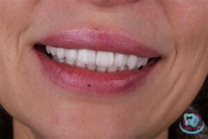 Красивая улыбка