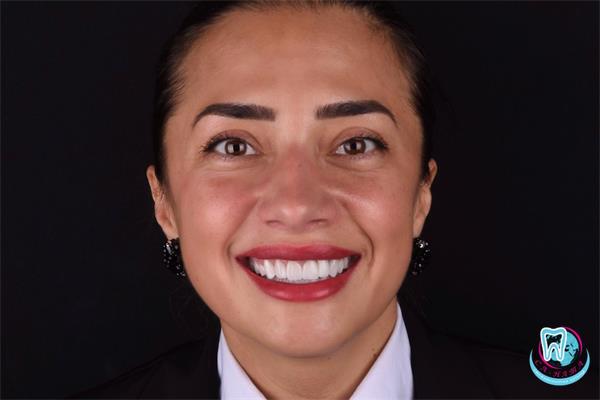 Красивая улыбка