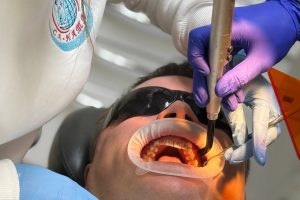 Встановлення брекетів